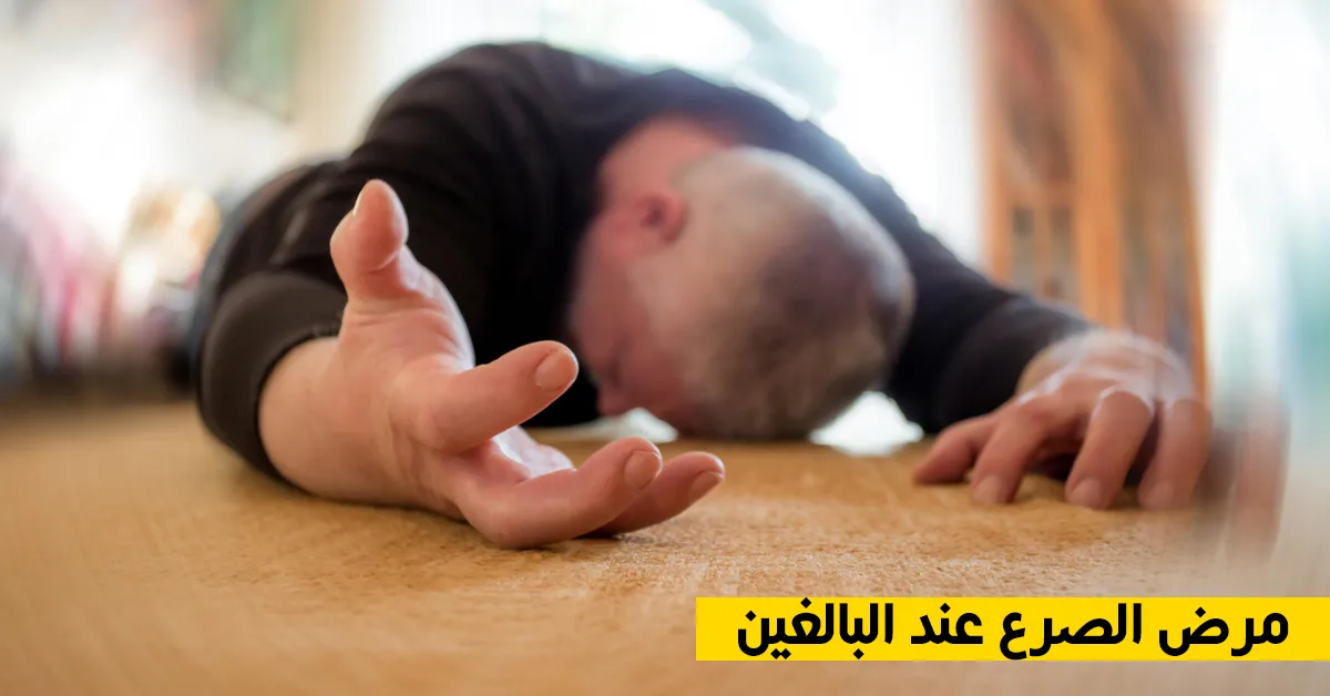 مرض الصرع عند البالغين